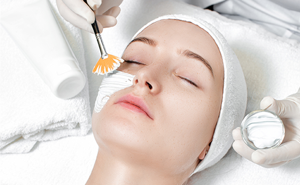 chemical-peel-treatment-1